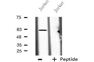 Western blot analysis of extracts from Jurkat cells, using CES2 antibody. (CES2 抗体  (N-Term))