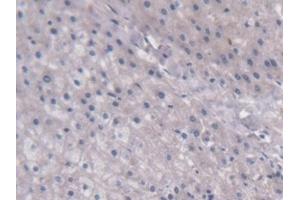 Detection of UCP2 in Human Liver Tissue using Monoclonal Antibody to Mitochondrial Uncoupling Protein 2 (UCP2) (UCP2 抗体  (AA 154-289))