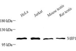 Western blot analysis of N4BP1 (ABIN7074790),at dilution of 1: 1000,Lane 1: HeLa cell lysate,Lane 2: Jurkat cell lysate,Lane 3: Mouse testis tissue lysate,Lane 4: Rat testis tissue lysate (N4BP1 抗体)