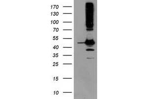Western Blotting (WB) image for anti-serpin Peptidase Inhibitor, Clade B (Ovalbumin), Member 13 (SERPINB13) antibody (ABIN1500877) (SERPINB13 抗体)