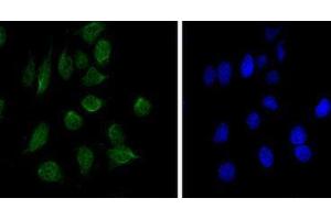 Immunocytochemistry (ICC) image for anti-Chromodomain Helicase DNA Binding Protein 3 (CHD3) antibody (ABIN2983311) (CHD3 抗体)