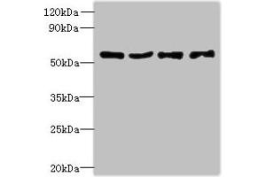 Western blot All lanes: UBA5 antibody at 6 μg/mL Lane 1: Jurkat whole cell lysate Lane 2: Hela whole cell lysate Lane 3: HepG2 whole cell lysate Lane 4: Caco-2 whole cell lysate Secondary Goat polyclonal to rabbit IgG at 1/10000 dilution Predicted band size: 45, 39 kDa Observed band size: 45 kDa (UBA5 抗体  (AA 291-404))