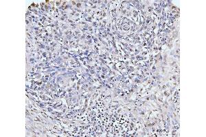 IHC analysis of KIFC1 using anti-KIFC1 antibody (ABIN7599523).