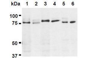 Western Blotting (WB) image for anti-UV Radiation Resistance Associated Gene (UVRAG) (AA 389-699) antibody (ABIN1449295) (UVRAG 抗体  (AA 389-699))