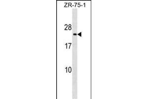 TMED3 Antibody (C-term) (ABIN1536734 and ABIN2849106) western blot analysis in ZR-75-1 cell line lysates (35 μg/lane). (TMED3 抗体  (C-Term))