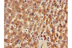 Immunohistochemistry of paraffin-embedded human liver tissue using ABIN7144576 at dilution of 1:100 (ARFIP2 抗体  (AA 20-295))