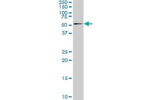 SMAD4 monoclonal antibody (M02), clone 3E2.