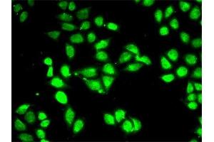 Immunofluorescence (IF) image for anti-Proteasome (Prosome, Macropain) 26S Subunit, ATPase, 3 (PSMC3) (AA 1-180) antibody (ABIN3022705)