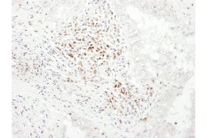 Immunohistochemistry (IHC) image for anti-CD3 epsilon (CD3E) (AA 157-207) antibody (ABIN7453426) (CD3 epsilon 抗体  (AA 157-207))
