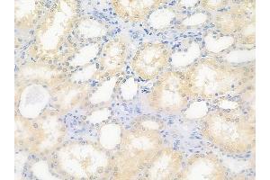 ABIN6264482 and ABIN6276710 at 1/100 staining human normal kidney tissue by IHC-P.