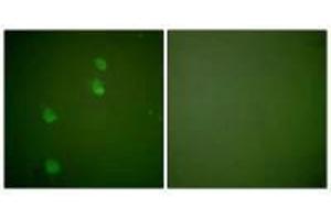 Immunofluorescence analysis of NIH/3T3 cells, using Cullin 2 antibody. (Cullin 2 抗体)