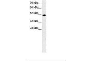Image no. 1 for anti-Interferon Regulatory Factor 9 (IRF9) (AA 41-90) antibody (ABIN6735770) (IRF9 抗体  (AA 41-90))