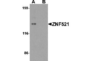 Western blot analysis of ZNF521 in HeLa cell lysate with ZNF521 antibody at 1 µg/mL in (A) the absence and (B) the presence of blocking peptide. (ZNF521 抗体  (N-Term))