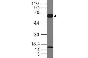 Image no. 1 for anti-Interleukin 1 Receptor-Like 2 (IL1RL2) (AA 1-203) antibody (ABIN5027304) (IL1RL2 抗体  (AA 1-203))