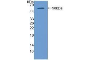 Detection of Recombinant GbA, Mouse using Polyclonal Antibody to Glucocerebrosidase (GBA) (GBA 抗体  (AA 255-509))
