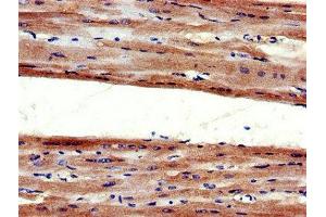 Immunohistochemistry of paraffin-embedded human heart tissue using ABIN7173980 at dilution of 1:100 (Angiotensin II Type-1 Receptor 抗体  (AA 306-356))