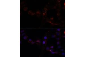 Immunofluorescence analysis of  cells using C antibody (ABIN7266034) at dilution of 1:100. (Calpain 7 抗体  (AA 20-220))