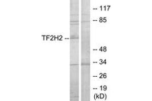 Western blot analysis of extracts from COLO205 cells, using TF2H2 Antibody. (GTF2H2 抗体  (AA 1-50))