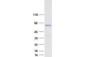 Western Blotting (WB) image for Wilms Tumor 1 Associated Protein (WTAP) (Transcript Variant 1) protein (Myc-DYKDDDDK Tag) (ABIN2735639)