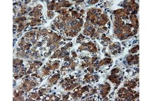 Immunohistochemical staining of paraffin-embedded pancreas tissue using anti-LIPG mouse monoclonal antibody. (LIPG 抗体)
