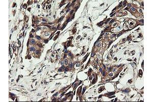 Image no. 9 for anti-Ubiquitin-Conjugating Enzyme E2, J1, U (UBE2J1) antibody (ABIN1501637)