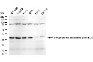Western blotting analysis using Synaptosome associated protein 29 antibody (ABIN7800488).