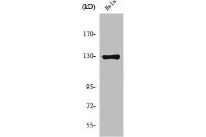 Western Blot analysis of HeLa cells using NOS2 Polyclonal Antibody (NOS2 抗体  (C-Term))
