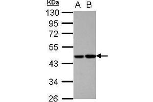 WB Image Sample (30 ug of whole cell lysate) A: HepG2 B: HCT116 10% SDS PAGE antibody diluted at 1:1000 (PROC 抗体)