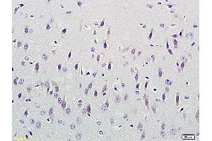 Formalin-fixed and paraffin embedded mouse kidney labeled with Anti-CUEDC2/CUE domain containing 2 Polyclonal Antibody, Unconjugated (ABIN707531) at 1:300 followed by conjugation to the secondary antibody and DAB staining (CUEDC2 抗体  (AA 201-287))