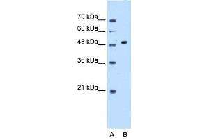 WB Suggested Anti-GTDC1 Antibody Titration:  0. (GTDC1 抗体  (N-Term))