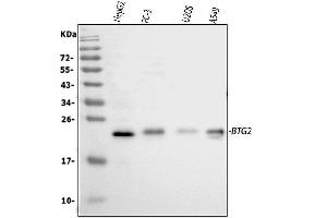 Western blot analysis of BTG2 using anti-BTG2 antibody (ABIN5692800).