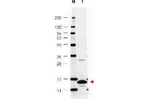 Image no. 1 for anti-Colony Stimulating Factor 2 (Granulocyte-Macrophage) (CSF2) antibody (ABIN401109) (GM-CSF 抗体)