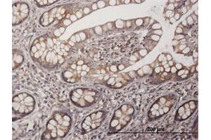 Immunoperoxidase of purified MaxPab antibody to PAGE1 on formalin-fixed paraffin-embedded human small Intestine. (PAGE1 抗体  (AA 1-146))