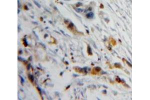 Used in DAB staining on fromalin fixed paraffin-embedded Pancreas tissue (PIP 抗体  (AA 1-146))