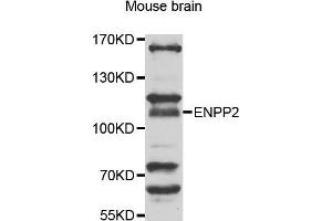 Western Blotting (WB) image for anti-Ectonucleotide Pyrophosphatase/phosphodiesterase 2 (ENPP2) (AA 564-863) antibody (ABIN6219607) (ENPP2 抗体  (AA 564-863))