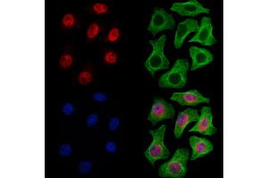 ABIN7094825 and ABIN7098876 staining Hela cells by IF/ICC.