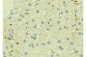 ABIN6277274 at 1/100 staining Mouse liver tissue by IHC-P. (TGFBI 抗体  (N-Term))