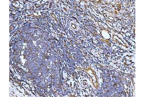 IHC analysis of Filamin B/FLNB using anti-Filamin B/FLNB antibody (ABIN7601606). (FLNB 抗体  (AA 397-701))