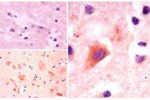 Image no. 1 for anti-Autophagy Related 10 (ATG10) (AA 1-50) antibody (ABIN960090) (ATG10 抗体  (AA 1-50))