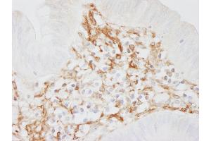 Immunohistochemistry (IHC) image for anti-Filamin A, alpha (FLNA) (AA 2597-2647) antibody (ABIN7454721) (Filamin A 抗体  (AA 2597-2647))