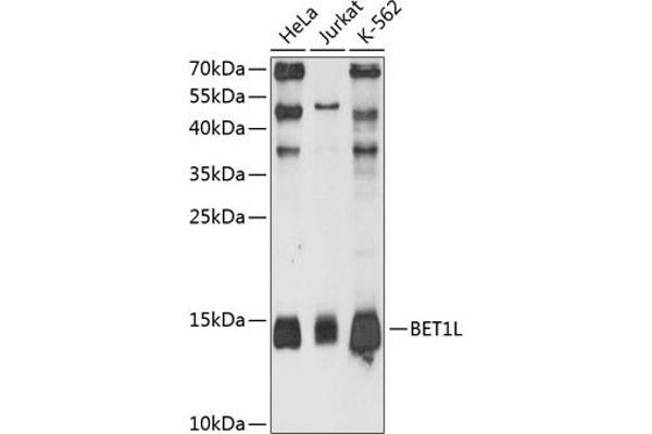 BET1L 抗体  (AA 1-60)