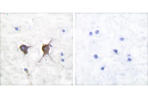 Peptide - +Immunohistochemical analysis of paraffin-embedded human brain tissue using Bax antibody (#C0132). (BAX 抗体)