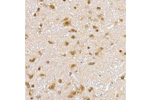 Immunohistochemistry of paraffin-embedded rat brain using PPCS Rabbit mAb (ABIN7269360) at dilution of 1:25 (40x lens).