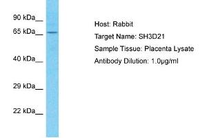 Host: Rabbit Target Name: SH3D21 Sample Tissue: Human Placenta Antibody Dilution: 1ug/ml (SH3D21 抗体  (C-Term))