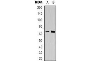 Western blot analysis of CSGALNACT2 expression in K562 (A), Jurkat (B) whole cell lysates. (CSGALNACT2 抗体)
