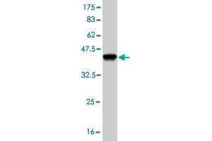 Western Blot detection against Immunogen (37. (PLD1 抗体  (AA 965-1074))