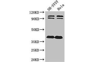 Western Blot Positive WB detected in: SH-SY5Y whole cell lysate, Hela whole cell lysate All lanes: DISC1 antibody at 2 μg/mL Secondary Goat polyclonal to rabbit IgG at 1/50000 dilution Predicted band size: 94, 92, 74, 39, 83, 63, 61, 76, 73, 38, 22 kDa Observed band size: 94, 92, 38 kDa (DISC1 抗体  (AA 99-325))