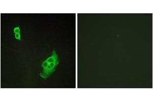 Immunofluorescence analysis of COS7 cells, using WAVE1 (Ab-125) Antibody. (WASF1 抗体  (AA 91-140))