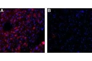 Immunohistochemistry (IHC) image for anti-Small Conductance Calcium-Activated Potassium Channel Protein 3 (KCNN3) (AA 2-21), (Intracellular) antibody (Atto 594) (ABIN7043632)