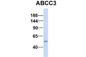 Western Blotting (WB) image for anti-ATP-Binding Cassette, Sub-Family C (CFTR/MRP), Member 3 (ABCC3) (Middle Region) antibody (ABIN2781505)